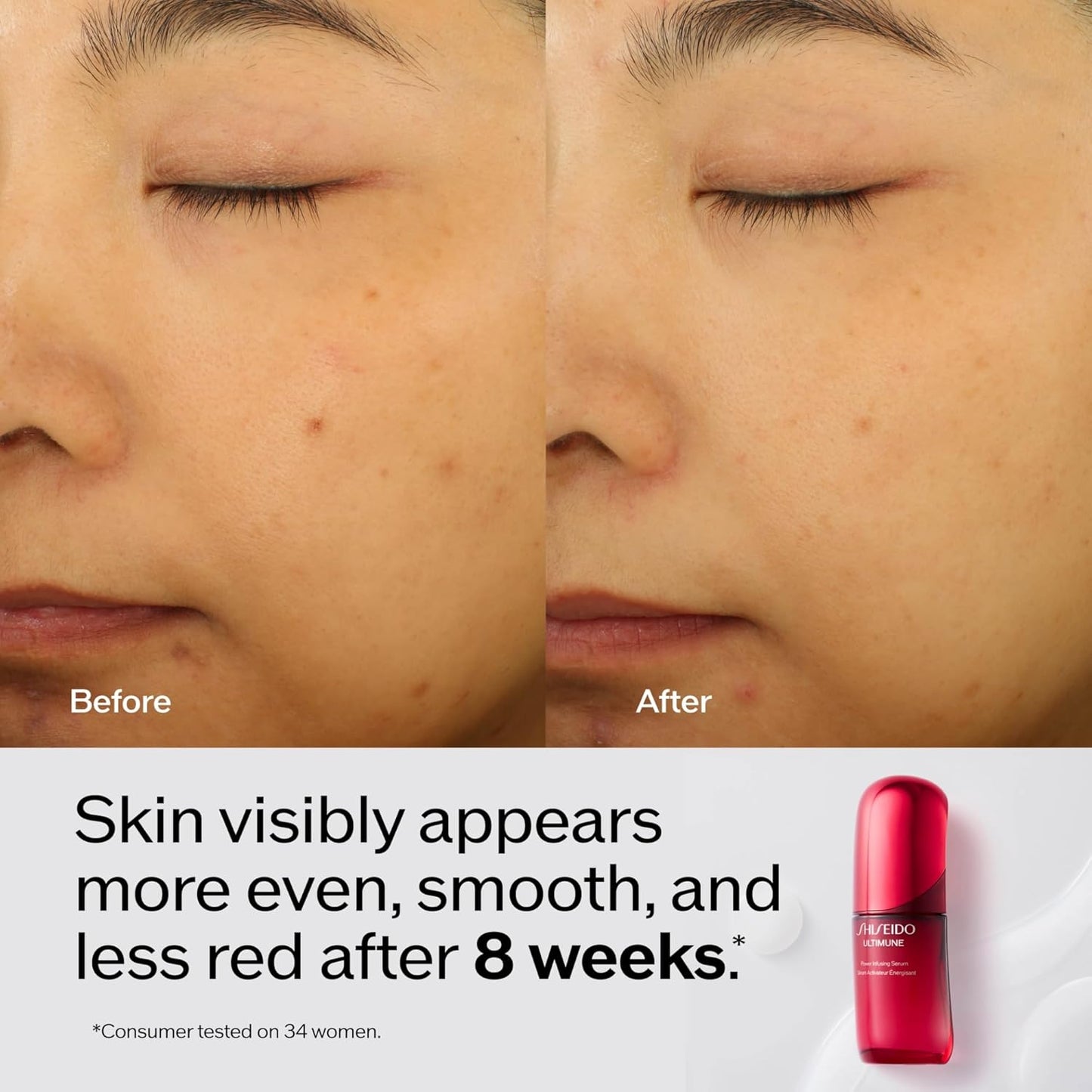Shiseido Ultimune Power Infusing Serum - Breakthrough Lightweight Face Serum - Boosts Radiance & Improves Visible Signs of Aging - All Skin Types - Non-Comedogenic