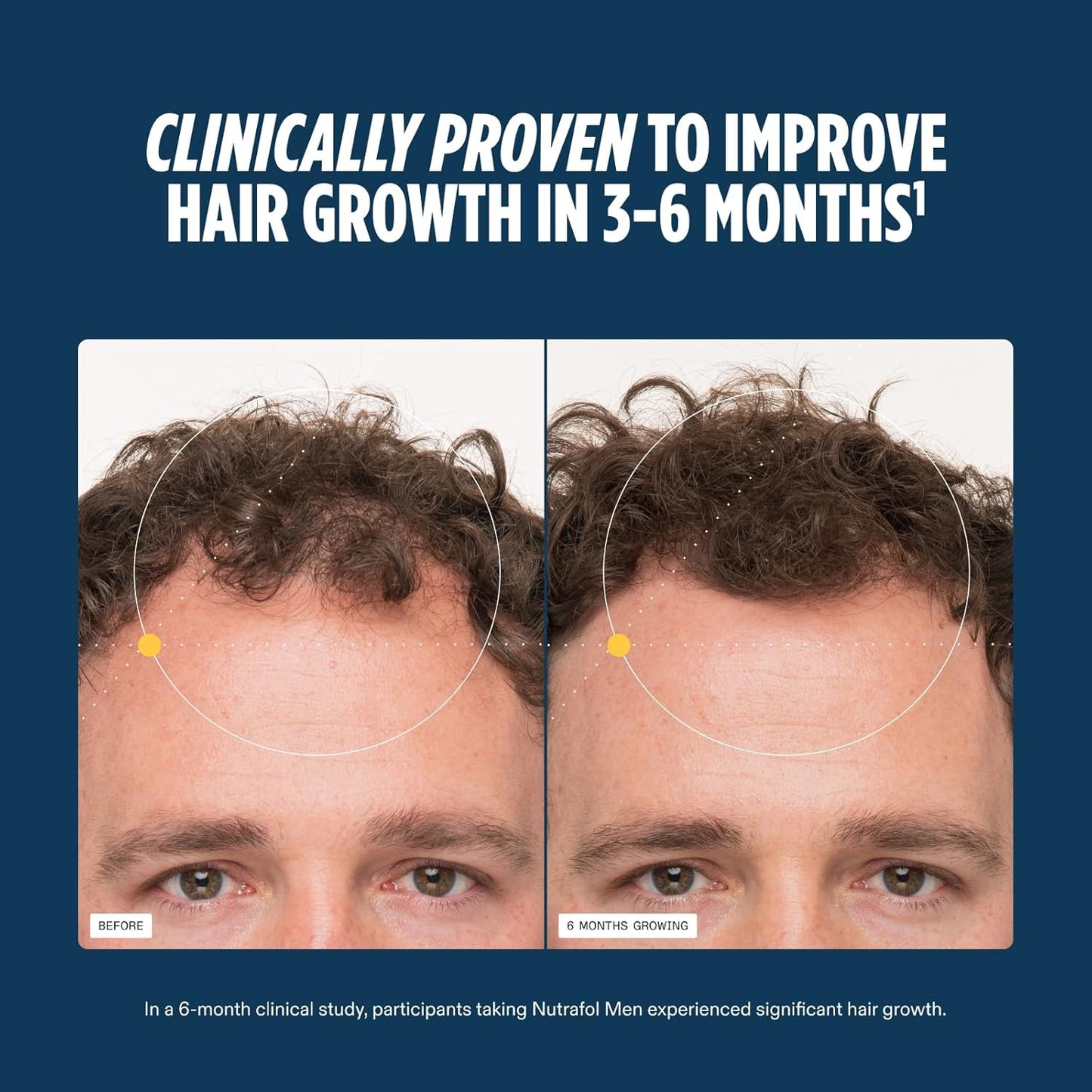 Nutrafol Men's Hair Growth Supplements, Clinically Tested for Visibly Thicker Hair and Scalp Coverage, Dermatologist