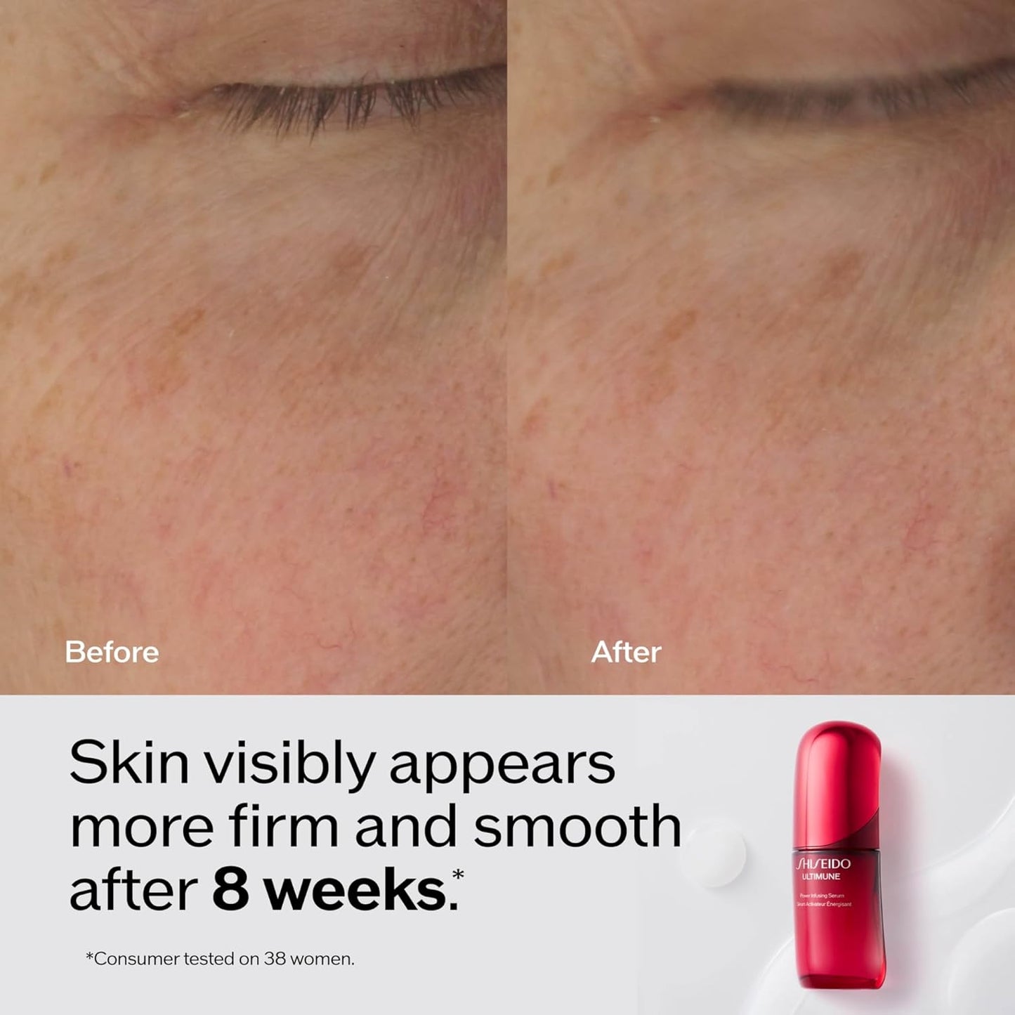 Shiseido Ultimune Power Infusing Serum - Breakthrough Lightweight Face Serum - Boosts Radiance & Improves Visible Signs of Aging - All Skin Types - Non-Comedogenic