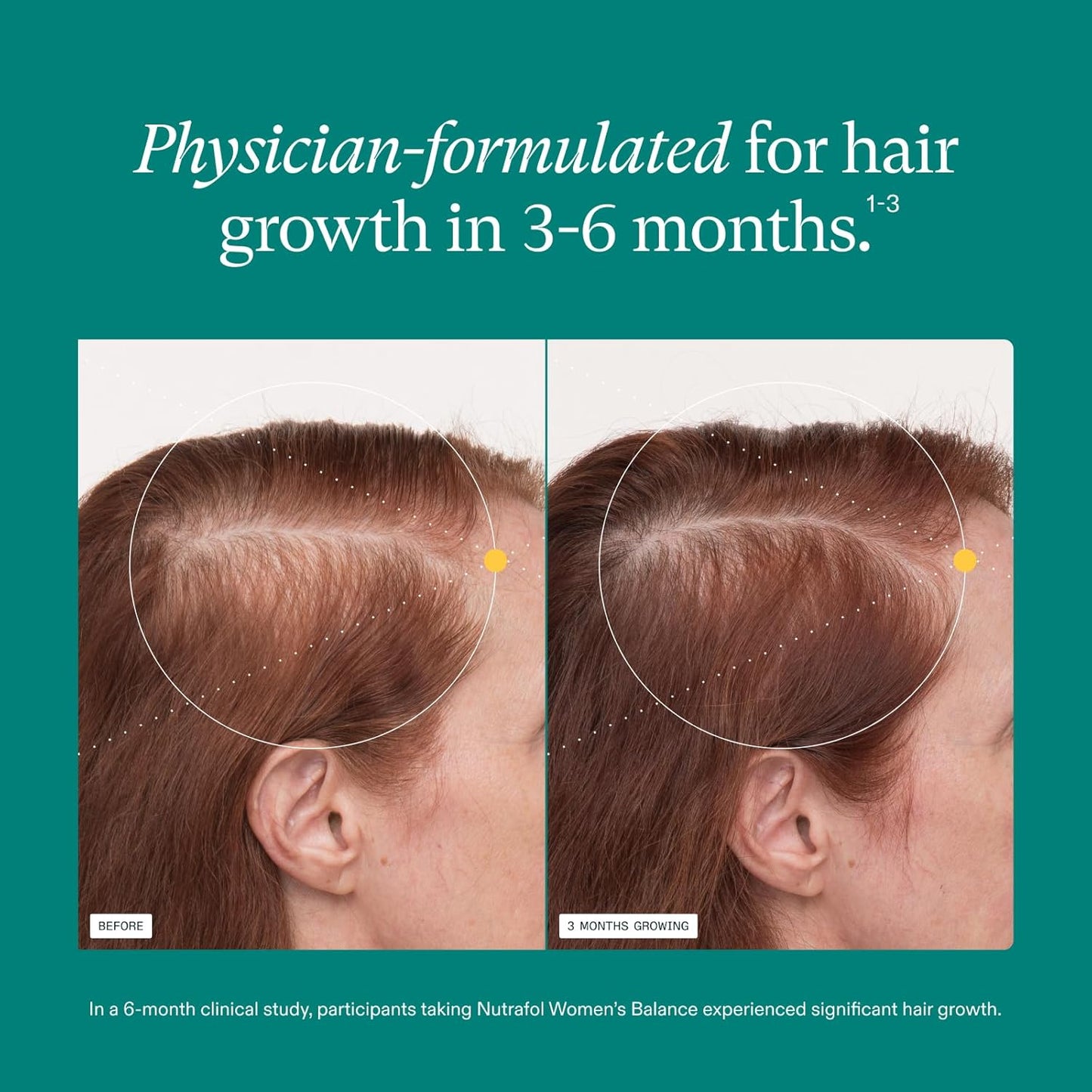 Nutrafol Women's Balance Hair Growth Supplements, Ages 45 and Up, Clinically Proven for Visibly Thicker Hair and Scalp Coverage, Dermatologist