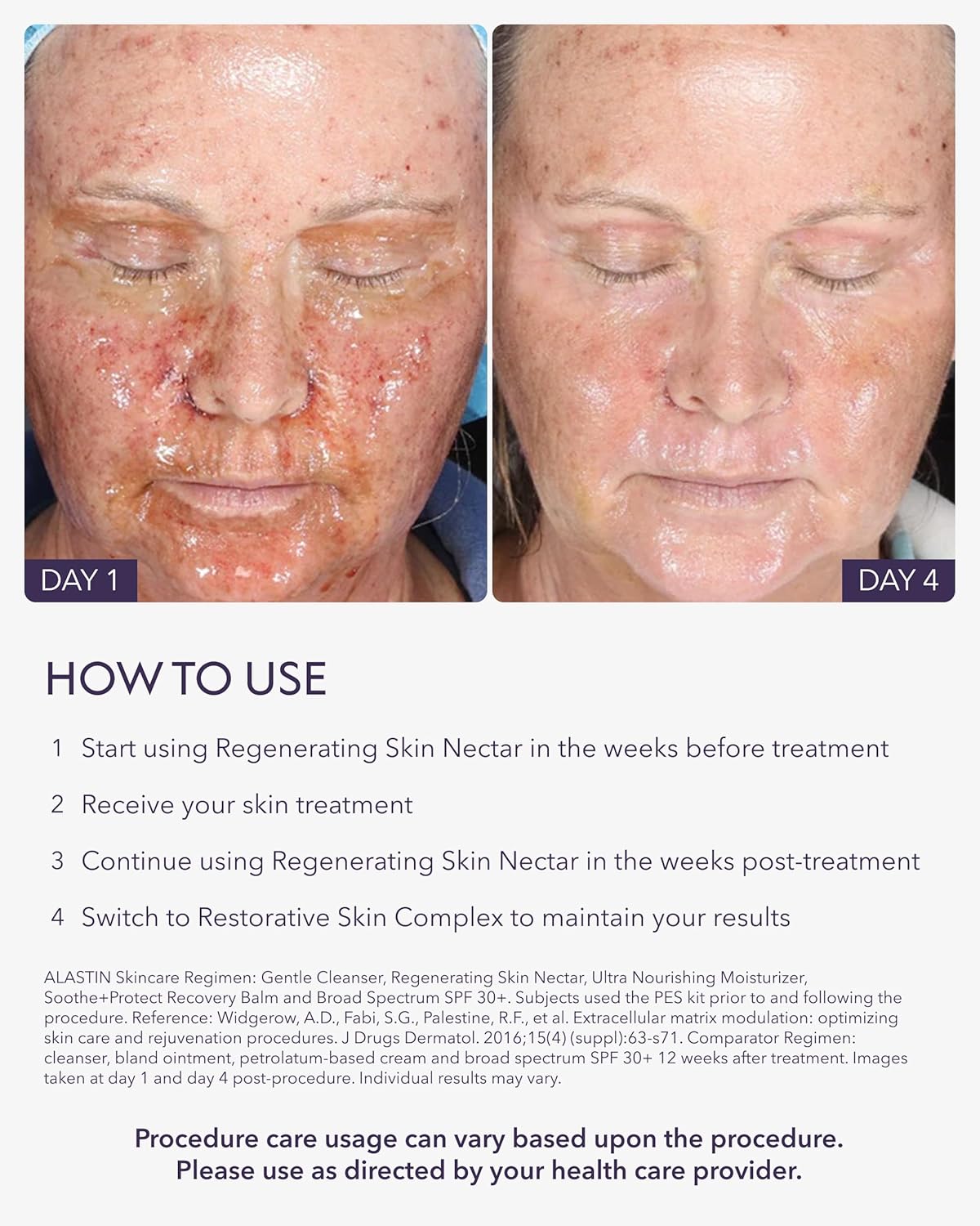ALASTIN Skincare Regenerating Skin Nectar Face Moisturizer (1 oz) | Hydrating Serum Strengthens & Soothes Post-Procedure Skin | Safe for Sensitive Skin