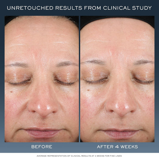 Lancôme Advanced Génifique Night Cream - Repairs Skin Barrier Overnight - With Bifidus Prebiotic, Hyaluronic Acid & Triple Ceramide Complex - 1.7 Fl Oz