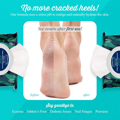 pHeet® Foot Wipes All-Natural Antifungal & Antibacterial Formula, Cleanses, Moisturizes, Prevents & Kills Athletes Foot, Toenail & Foot Fungus, Odor & Improves Dry, Cracked, Flaky & Diabetic Skin 72ct