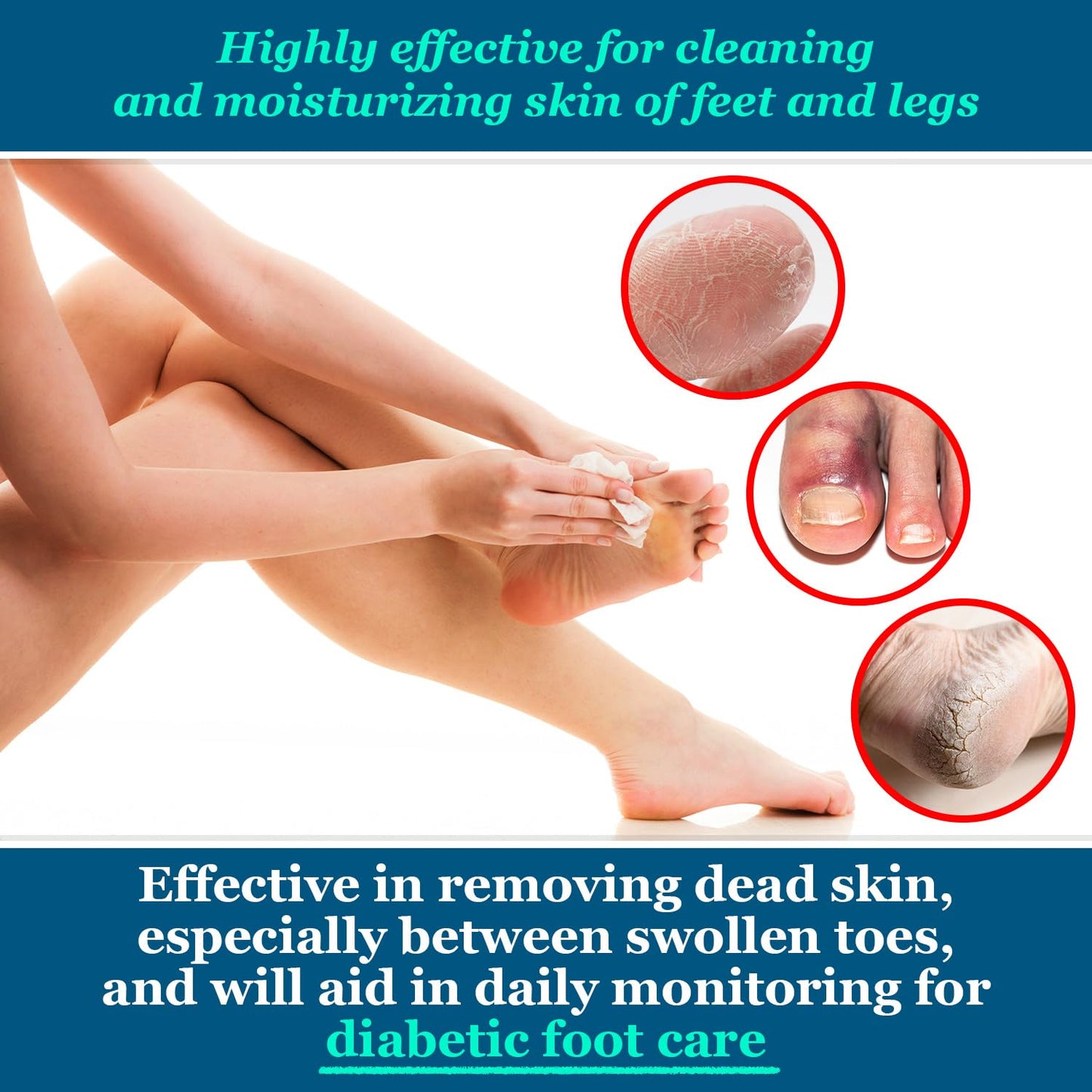 pHeet® Foot Wipes All-Natural Antifungal & Antibacterial Formula, Cleanses, Moisturizes, Prevents & Kills Athletes Foot, Toenail & Foot Fungus, Odor & Improves Dry, Cracked, Flaky & Diabetic Skin 72ct