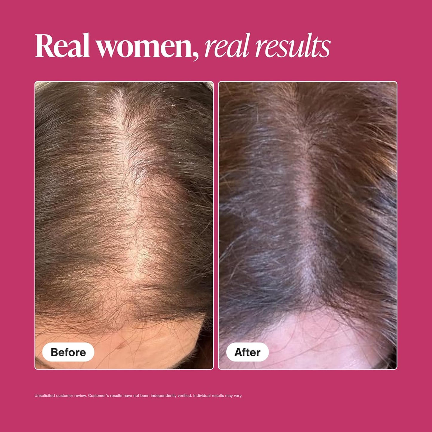 Viviscal Hair Growth Supplements for Women, Thicker Fuller Hair Support for Thinning Hair and Hair Loss, with Biotin and Marine Collagen, Drug-Free, 180 Tablets