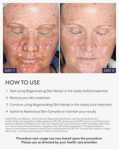 ALASTIN Skincare Regenerating Skin Nectar Face Moisturizer (1 oz) | Hydrating Serum Strengthens & Soothes Post-Procedure Skin | Safe for Sensitive Skin